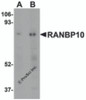 Western blot analysis of RANBP10 in human skeletal muscle tissue lysate with RANBP10 antibody at (A) 1 and (B) 2 &#956;g/mL.
