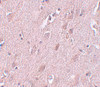 Immunohistochemistry of ZC3H12B in human brain tissue with ZC3H12B antibody at 5 ug/mL.