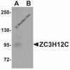 Western blot analysis of ZC3H12C in rat brain tissue lysate with ZC3H12C antibody at 1 &#956;g/mL in (A) the absence and (B) the presence of blocking peptide.