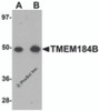 Western blot analysis of TMEM184B in rat lung tissue lysate with TMEM184B antibody at (A) 1 and (B) 2 &#956;g/mL.