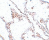 Immunohistochemistry of TMEM184B in human lung tissue with TMEM184B antibody at 5 ug/mL.