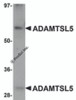 Western blot analysis of ADAMTSL5 in human skeletal muscle tissue lysate with ADAMTSL5 antibody at 1 &#956;g/mL.