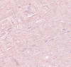 Immunohistochemistry of ADAMTSL5 in mouse skeletal muscle tissue with ADAMTSL5 antibody at 5 ug/mL.