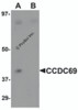 Western blot analysis of CCDC69 in mouse lung tissue lysate with CCDC69 antibody at 1 &#956;g/mL in (A) the absence and (B) the presence of blocking peptide.