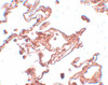 Immunohistochemistry of CCDC69 in human lung tissue with CCDC69 antibody at 5 ug/mL.