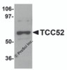 Western blot analysis of TCC52 in 293 cell lysate with TCC52 antibody at 1 &#956;g/mL.
