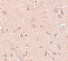 Immunohistochemistry of TINP1 in human brain tissue with TINP1 antibody at 5 ug/mL.