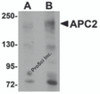 Western blot analysis of APC2 in HeLa cell lysate with APC2 antibody at (A) 1 and (B) 2 &#956;g/mL.