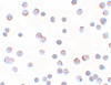 Immunocytochemistry of APC2 in HeLa cells with APC2 antibody at 5 ug/mL.
