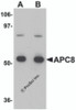 Western blot analysis of APC8 in K562 cell lysate with APC8 antibody at (A) 1 and (B) 2 &#956;g/mL.