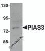 Western blot analysis of PIAS3 in K562 cell lysate with PIAS3 antibody at 1 &#956;g/mL.
