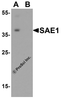 Western blot analysis of SAE1 in SK-N-SH lysate with SAE1 antibody at 0.5 &#956;g/mL in (A) the absence and (B) the presence of blocking peptide.