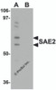 Western blot analysis of SAE2 in 293 cell lysate with SAE2 antibody at 0.25 &#956;g/mL in (A) the absence and (B) the presence of blocking peptide.