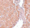 Immunohistochemistry of SUMO2/3 in rat liver tissue with SUMO2/3 antibody at 5 ug/mL.