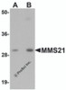 Western blot analysis of MMS21 in 293 cell lysate with MMS21 antibody at (A) 0.5 and (B) 1 &#956;g/mL.