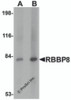 Western blot analysis of RBBP8 in mouse spleen tissue lysate with RBBP8 antibody at (A) 1 and (B) 2 &#956;g/mL.