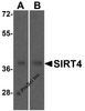 Western blot analysis of SIRT4 in (A) human and (B) mouse liver tissue lysate with SIRT4 antibody at 0.5 &#956;g/mL
