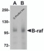 Figure 1 Western Blot Validation in Human Brain Tissue
Loading: 15 &#956;g of lysates per lane.
Antibodies: B-raf 5777, (A:1 &#956;g/mL; B:2 &#956;g/mL) , 1h incubation at RT in 5% NFDM/TBST.
Secondary: Goat anti-chicken IgG HRP conjugate at 1:10000 dilution.