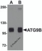 Western blot analysis of ATG9B in HeLa cell lysate with ATG9B antibody at (A) 1 and (B) 2 &#956;g/mL.