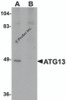 Western blot analysis of ATG13 in rat heart tissue lysate with ATG13 antibody at 1 &#956;g/mL in (A) the absence and (B) the presence of blocking peptide.
