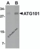 Western blot analysis of ATG101 in human liver tissue lysate with ATG101 antibody at (A) 1 and (B) 2 &#956;g/mL.