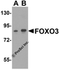 Western blot analysis of FOXO3 in A-20 cell lysate with FOXO3 antibody at (A) 0.5 and (B) 1 &#956;g/mL.