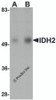 Western blot analysis of IDH2 in human heart tissue lysate with IDH2 antibody at (A) 1 and (B) 2 &#956;g/mL.
