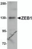 Western blot analysis of ZEB1 in HeLa cell lysate with ZEB1 antibody at 1&#956;g/mL.
