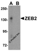 Western blot analysis of ZEB2 in EL4 cell lysate with ZEB2 antibody at 1 &#956;g/mL in (A) the absence and (B) the presence of blocking peptide.