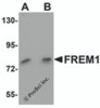 Western blot analysis of FREM1 in K562 cell lysate with FREM1 antibody at (A) 0.5 and (B) 1&#956;g/mL.