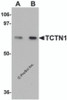 Western blot analysis of TCTN1 in mouse kidney tissue lysate with TCTN1 antibody at (A) 1 and (B) 2&#956;g/mL.
