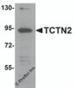 Western blot analysis of TCTN2 in SK-N-SH cell lysate with TCTN2 antibody at 1 &#956;g/mL.
