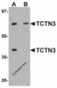 Western blot analysis of TCTN3 in HeLa cell lysate with TCTN3 antibody at (A) 1 and (B) 2&#956;g/mL.