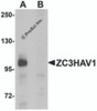 Western blot analysis of ZC3HAV1 in HeLa cell lysate with ZC3HAV1 antibody at 1&#956;g/mL in (A) the absence and (B) the presence of blocking peptide.