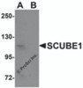 Western blot analysis of SCUBE1 in Daudi cell lysate with SCUBE1 antibody at 1 &#956;g/mL in (A) the absence and (B) the presence of blocking peptide.