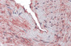 Immunohistochemistry of SCUBE3 in human blood vessel tissue with SCUBE3 antibody at 10 &#956;g/mL.