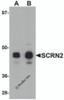 Western blot analysis of SCRN2 in 293 cell tissue lysate with SCRN2 antibody at (A) 0.5 and (B) 1 &#956;g/mL.