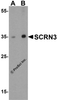Western blot analysis of SCRN3 in human breast tissue lysate with SCRN3 antibody at (A) 1 and (B) 2 &#956;g/mL.