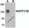 Western blot analysis of ATP11B in K562 cell tissue lysate with ATP11B antibody at 1 &#956;g/mL in (A) the absence and (B) the presence of blocking peptide.