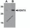 Western blot analysis of VENTX in mouse brain tissue lysate with VENTX antibody at (A) 1 and (B) 2 &#956;g/mL.