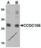 Western blot analysis of CCDC106 in human brain tissue lysate with CCDC106 antibody at (A) 0.5 and (B) 1 &#956;g/mL.