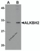 Western blot analysis of ALKBH2 in human kidney tissue lysate with ALKBH2 antibody at (A) 1 and (B) 2 &#956;g/mL.