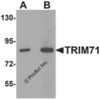 Western blot analysis of TRIM71 in human brain tissue lysate with TRIM71 antibody at (A) 1 and (B) 2 &#956;g/mL.