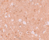 Immunohistochemistry of TRIM71 in human brain tissue with TRIM71 antibody at 5 ug/mL.