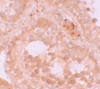 Immunohistochemistry of WDR92 in human testis tissue with WDR92 antibody at 10 ug/mL.