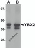 Western blot analysis of YBX2 in human testis tissue lysate with YBX2 antibody at (A) 1 and (B) 2 &#956;g/mL.