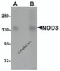 Western blot analysis of NOD3 in 3T3 cell lysate with NOD3 antibody at (A) 1 and (B) 2 &#956;g/mL.