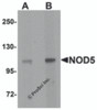 Western blot analysis of NOD5 in rat spleen tissue cell lysate with NOD5 antibody at (A) 1 and (B) 2 &#956;g/mL.