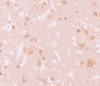 Immunohistochemistry of NALP7 in human brain tissue with NALP7 antibody at 10 ug/mL.