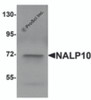 Western blot analysis of NALP10 in human brain tissue lysate with NALP10 antibody at 1 &#956;g/mL.